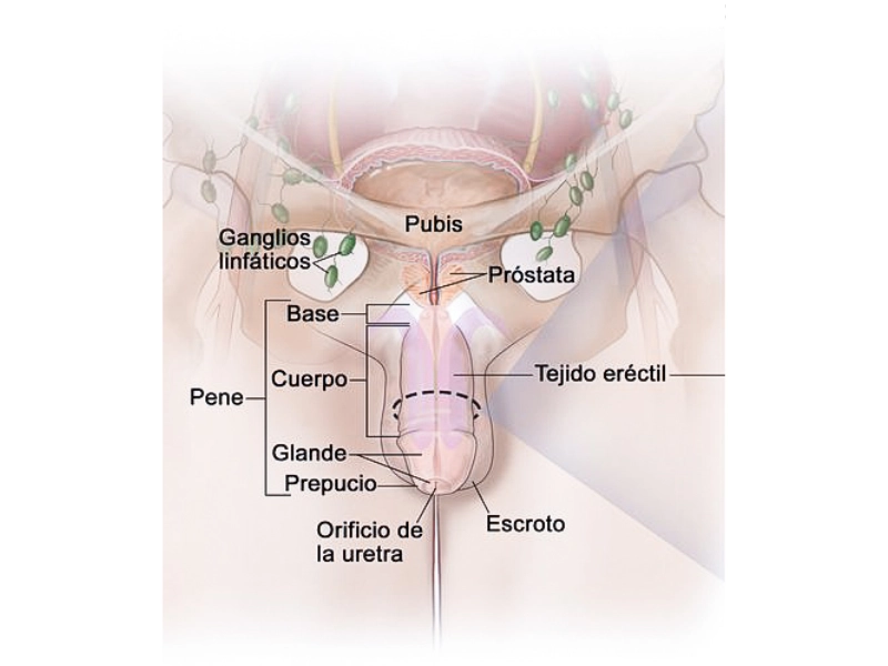 CÁNCER DE PENE